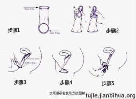 安全又舒适的避孕方式，除了女性上环还有没有其他的方法