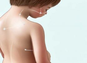 儿童酒精退烧擦拭部位图；小儿退烧酒精擦拭部位图片