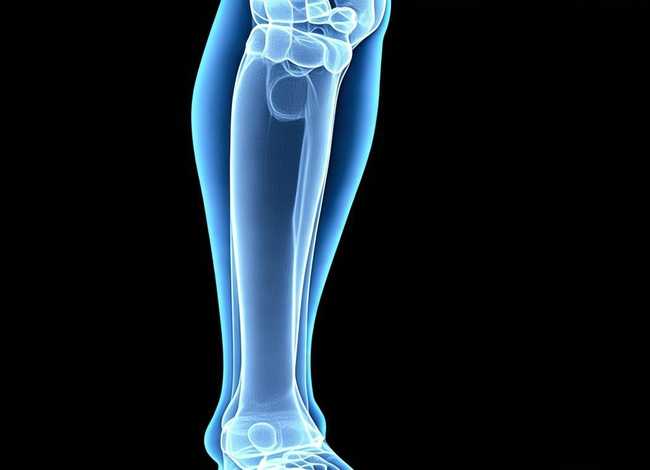 儿童胫骨囊肿的x片、儿童胫骨骨囊肿