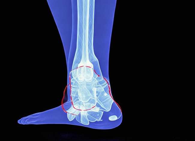 儿童胫骨囊肿的x片、儿童胫骨骨囊肿