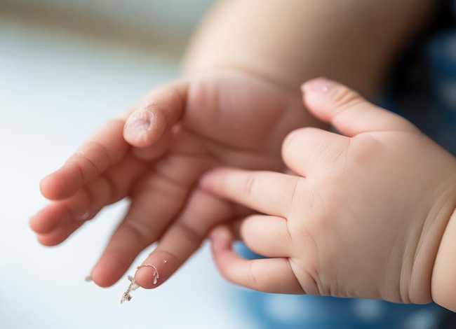 儿童手掌手指脱皮 儿童手掌手指脱皮图片