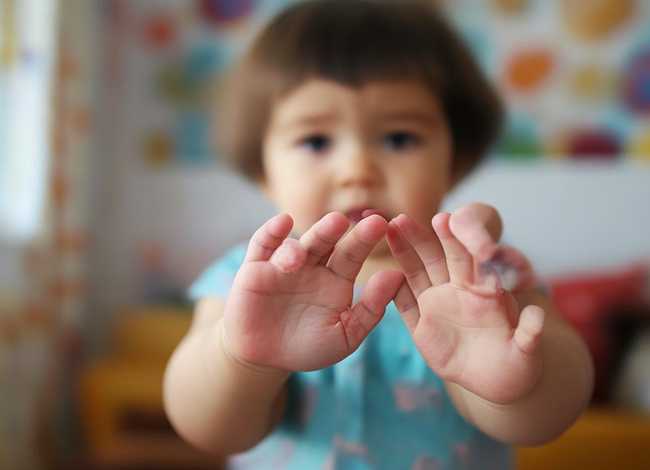 儿童手掌疼是怎么回事（小孩子手掌心疼怎么回事）