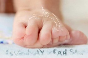 儿童夹脚的间隙尺寸、幼儿夹脚综合征的发病原因