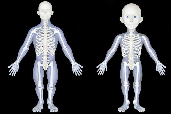 矮小症骨龄和正常骨龄的区别，矮小症骨龄和正常骨龄的区别在哪